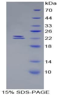 Mouse BMP1 Protein (Recombinant His)