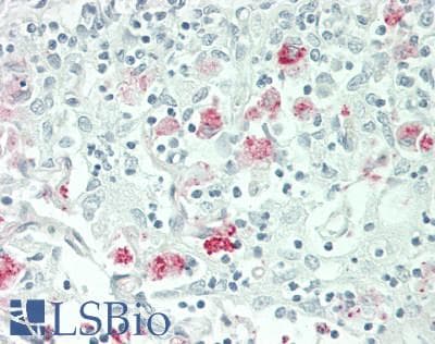 IHC-plus™ TMIGD2 Antibody (aa119-147)