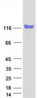 Human NELL2 Protein (Recombinant Myc-DDK (Flag))