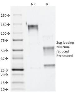 Alpha Catenin Antibody (clone 1G5)