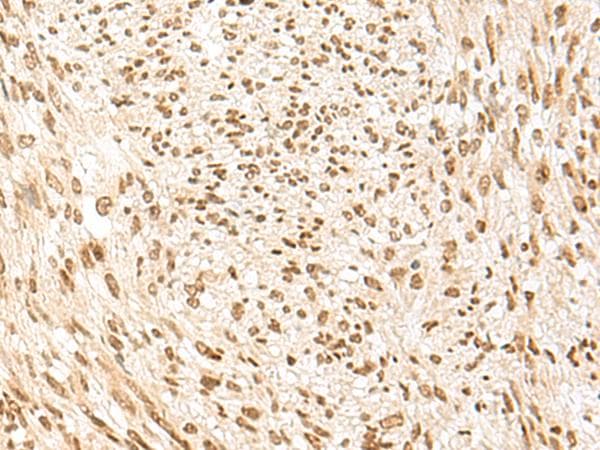POM121 Antibody