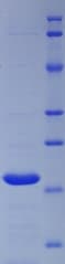 Human HSPD1 / HSP60 Protein (Recombinant His)