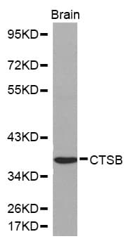 CTSB / Cathepsin B Antibody