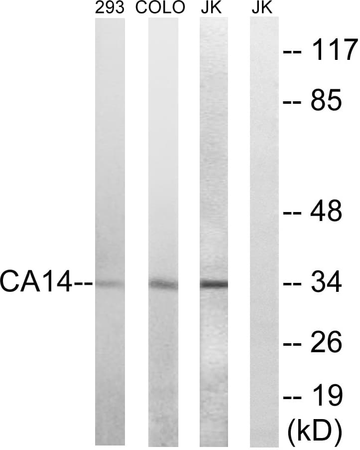 CA14 / Carbonic Anhydrase XIV Antibody (aa161-210)