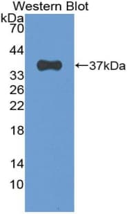 EIF2AK2 / PKR Antibody (aa205-495)