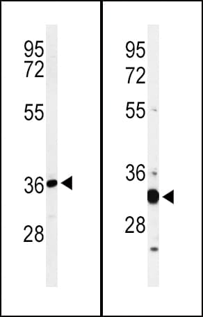 ST8SIA4 Antibody (aa186-214)