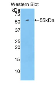 SLC27A5 / BACS Antibody (aa488-690)
