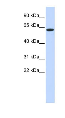 Polyclonal Rabbit anti-Human LINGO4 Antibody (aa468-517, WB)