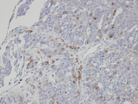 ST3GAL1 Antibody (aa1-195)