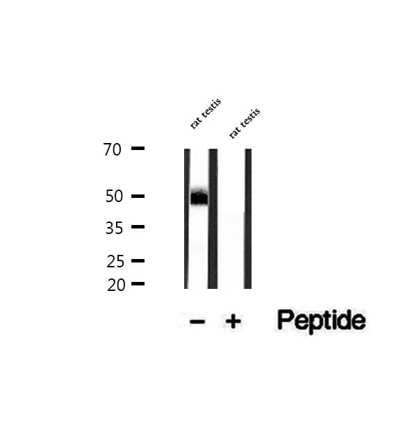 Polyclonal Rabbit anti-Human DYX1C1 Antibody (IHC, IF, WB)