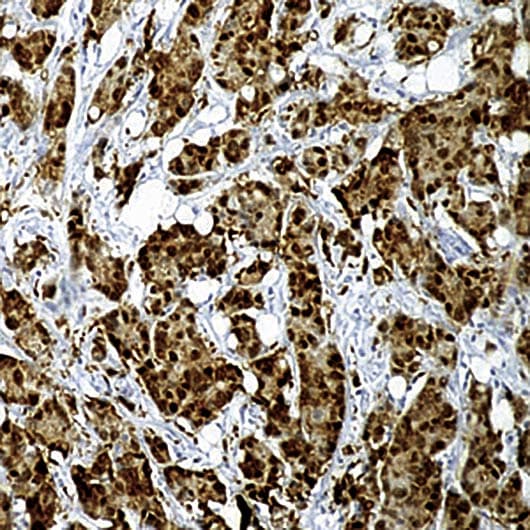 HSP70 / Heat Shock Protein 70 Antibody (clone W27)