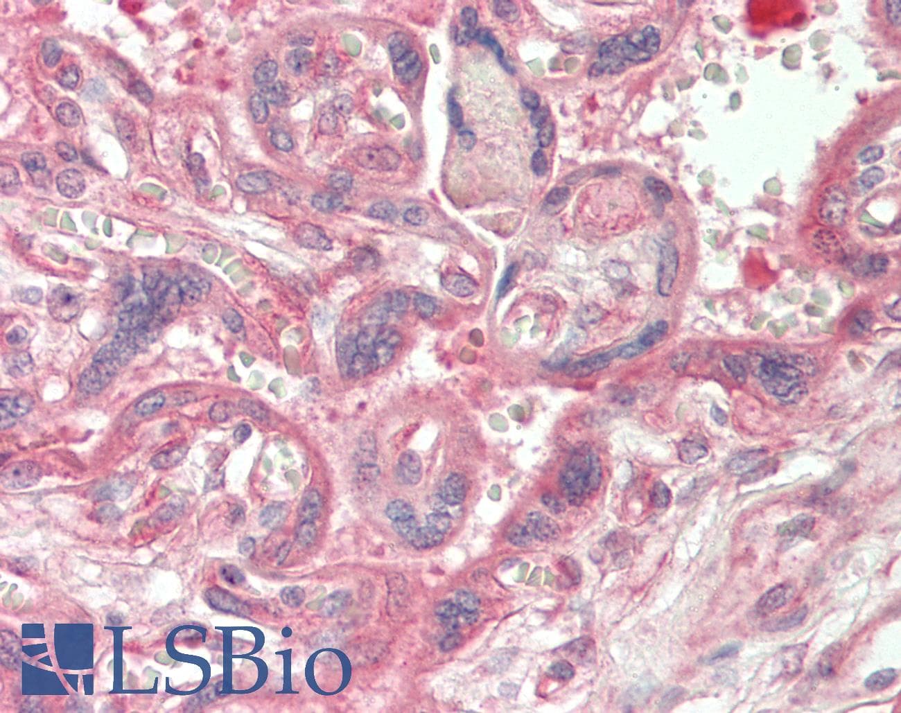 CAD Antibody (N-Terminus)