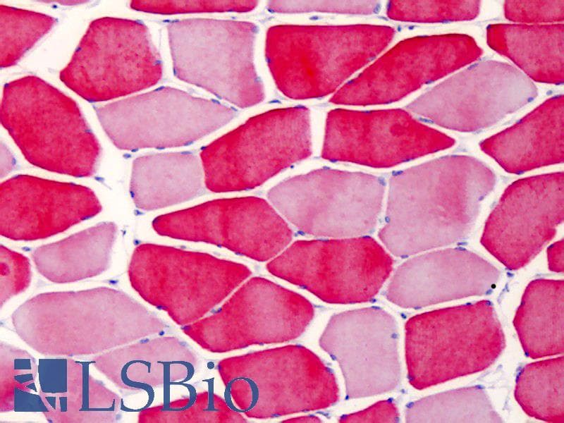 IHC-plus™ Monoclonal Mouse anti-Human TNNI2 Antibody (clone 11E6, IHC, WB)