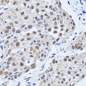 Polyclonal Rabbit anti-Human TP53BP1 / 53BP1 Antibody (IHC, IF, WB)