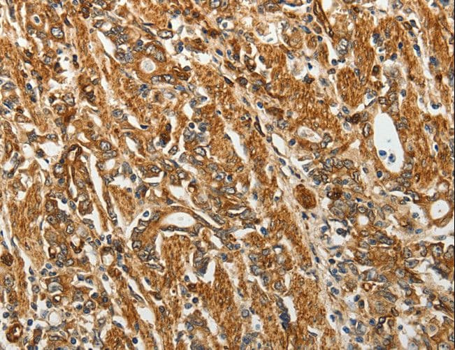 RPLP0 Antibody