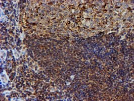 PSMB9 Antibody (clone OTI1G7)