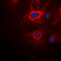 KRT8 / CK8 / Cytokeratin 8 Antibody (C-Terminus)