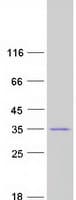 Human CHMP2B Protein (Recombinant Myc-DDK (Flag))