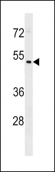 HEPACAM2 Antibody (aa371-400)