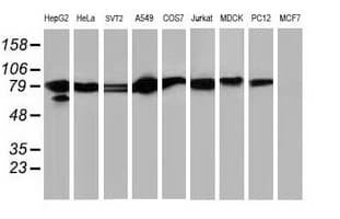 IHC-plus™ STAT5A Antibody (clone 9F7)