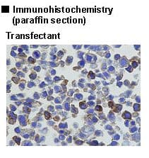 Polyclonal Rabbit GLB1 / Beta-Galactosidase Antibody (IHC, WB)