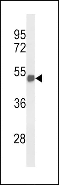 BF1 / FOXG1 Antibody (aa225-252)