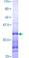 Human SEMA3B / SemA Protein (Recombinant GST, N-terminus)