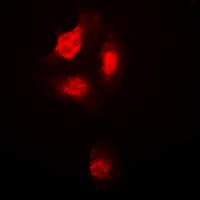 MAPK14 / p38 Antibody (phospho-Thr180)
