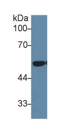 DLD / Diaphorase / E3 Antibody (aa280-487)