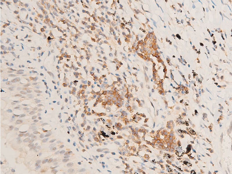 MAP3K7 / TAK1 Antibody (phospho-Thr187)