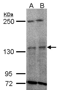 TYK2 Antibody (aa680-1187)