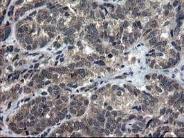 DOK7 Antibody (clone OTI7E2)