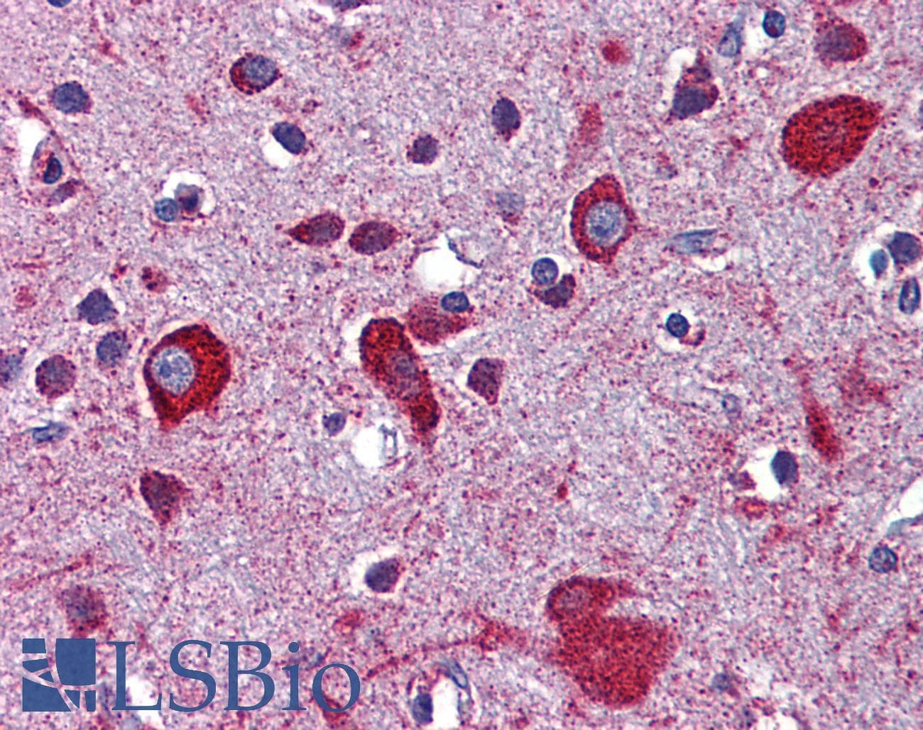 APOER2 / LRP8 Antibody (aa395-444, Biotin)