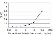 SET / TAF-I Antibody (clone M1-F5)