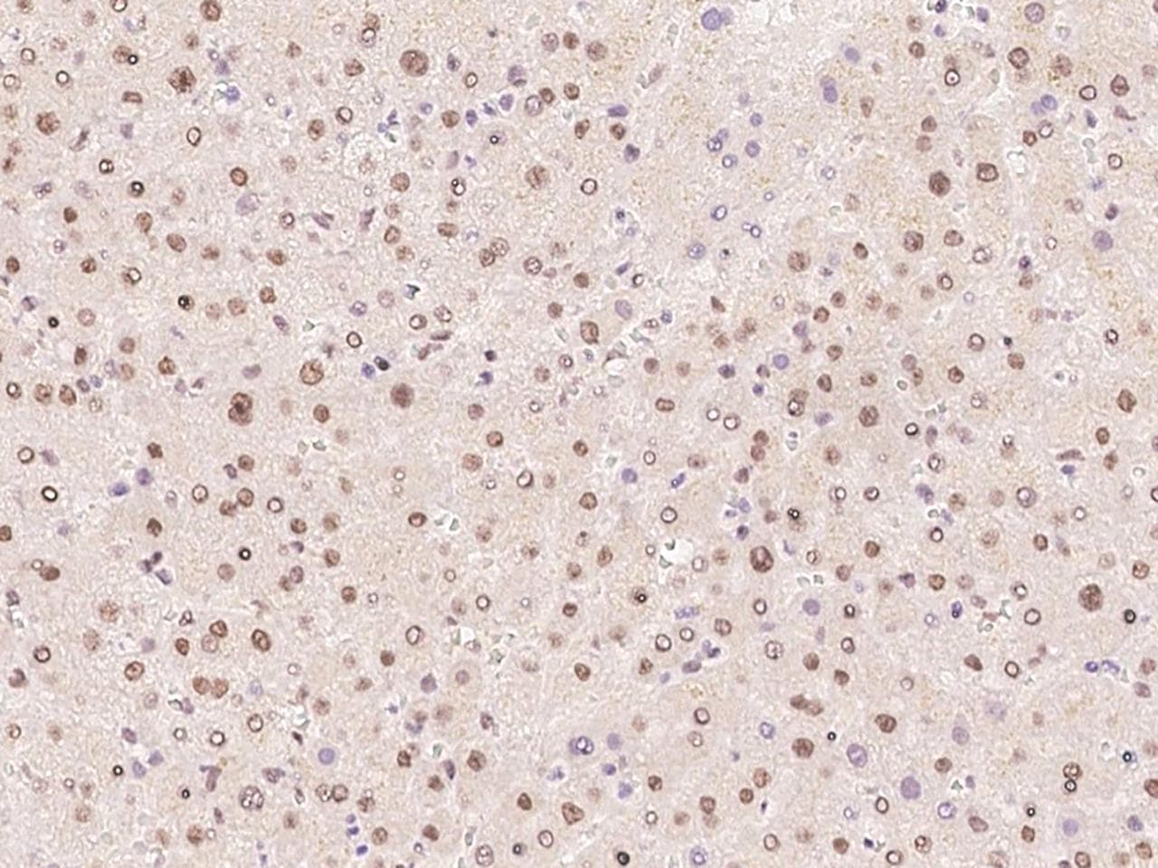 FBP2 Antibody