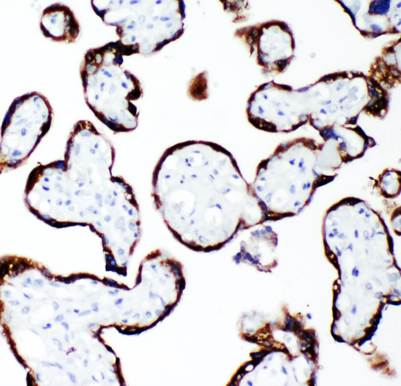 Polyclonal Rabbit anti-Human GH / Growth Hormone Antibody (aa27-217, IHC, WB)
