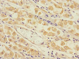 TPM4 Antibody