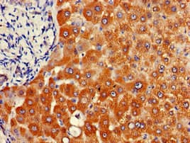 NAT1 / AAC1 Antibody