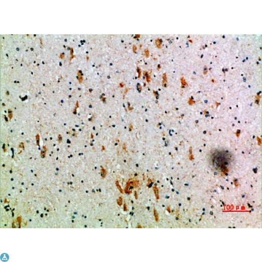 KIR3DL2 Antibody