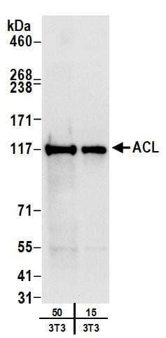 IHC-plus™ RPS3 / Ribosomal Protein S3 Antibody (aa193-243)