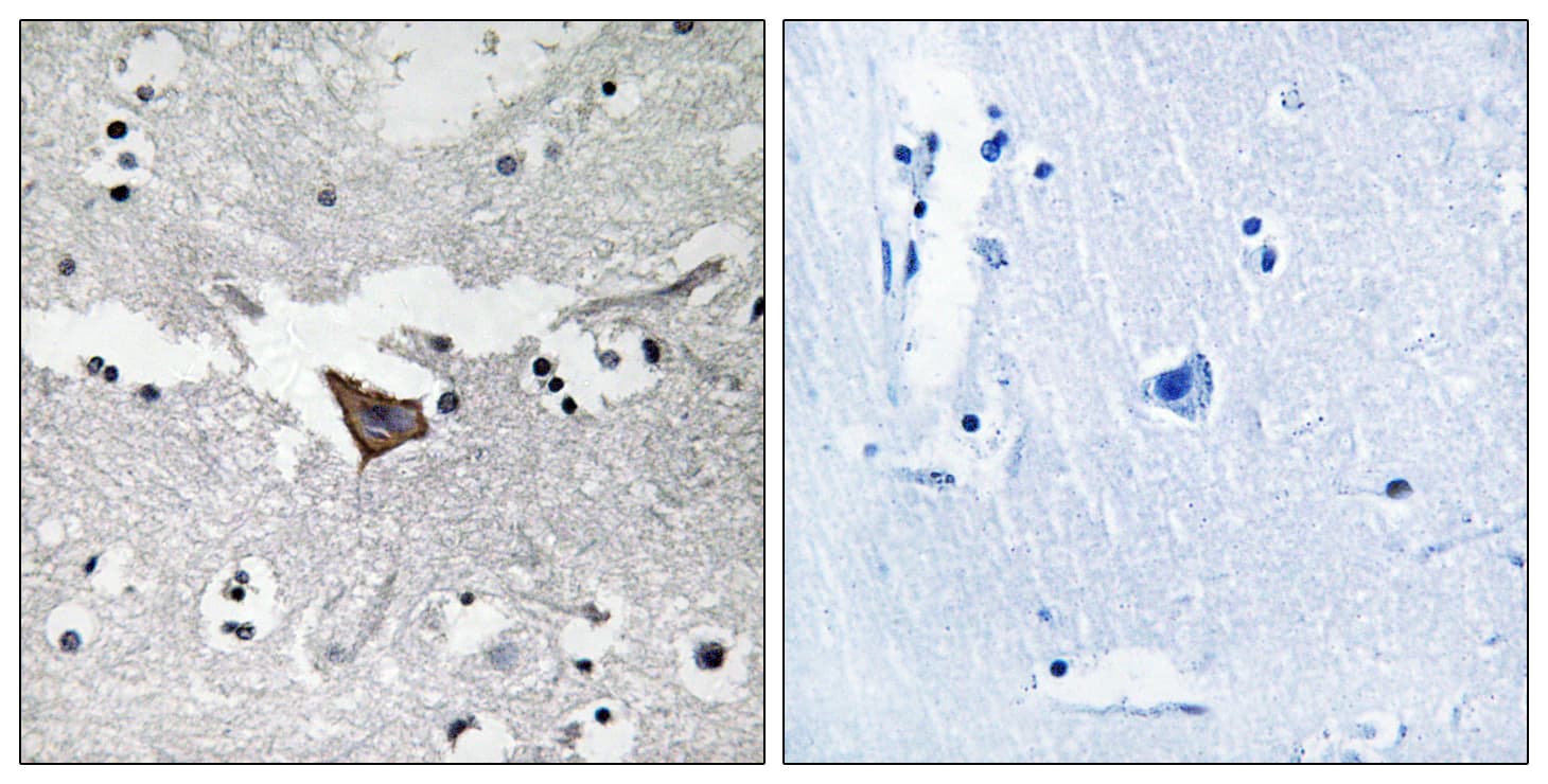FAK / Focal Adhesion Kinase Antibody (aa892-941)