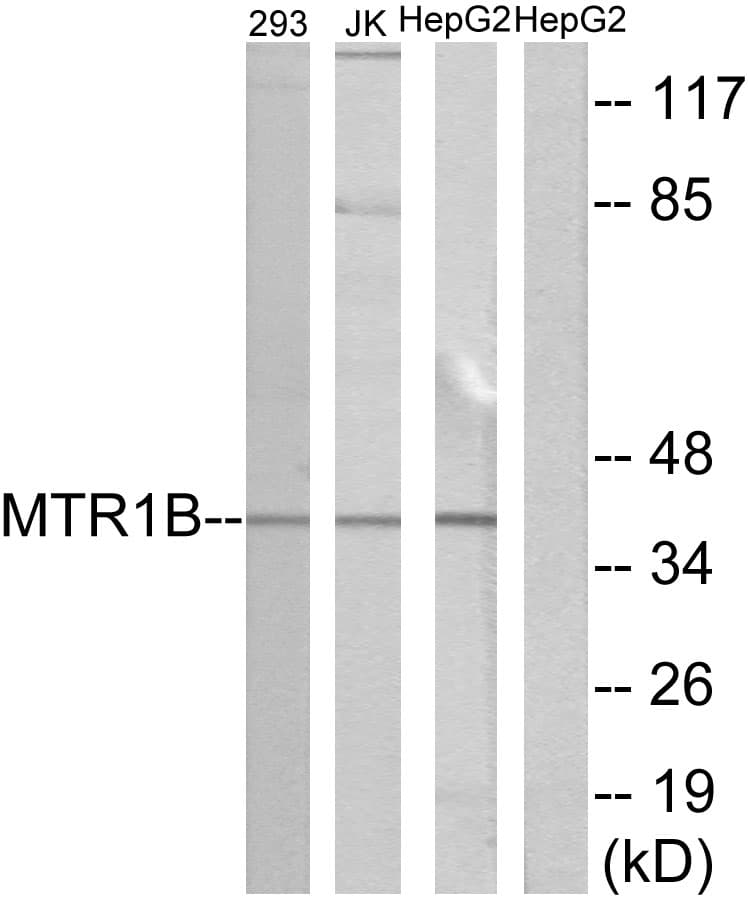 MTNR1B / MT2 Antibody (aa301-350)