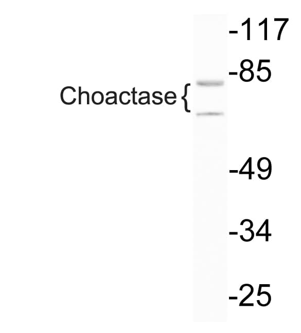 CHAT Antibody (aa334-383)