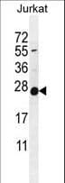 Polyclonal Rabbit anti-Human POLR2J Antibody (aa86-115, IHC, WB)