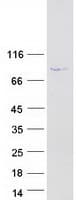 Human DRC1 / CCDC164 Protein (Recombinant Myc-DDK (Flag))