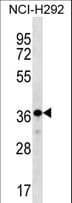 THAP8 Antibody (aa72-100)