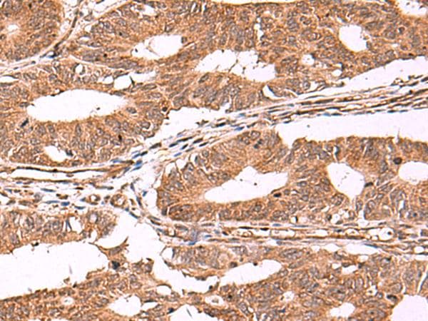 IST1 Antibody