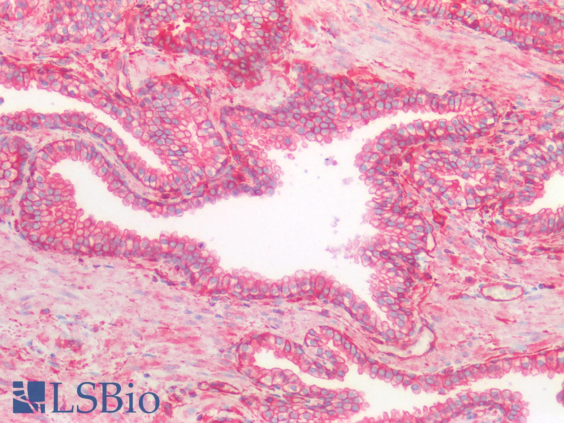 IHC-plus™ SPTAN1 / Alpha Fodrin Antibody