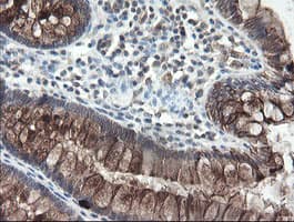 DPH2 Antibody (clone OTI2B12)