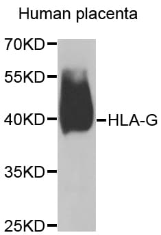 HLA-G Antibody